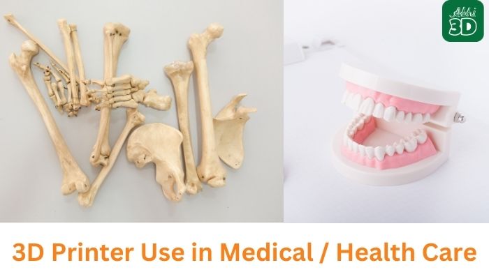 Uses of 3D Printer in medical / Heath Care 
